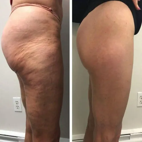 Resultado antes y después de usar Circulé